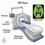 bet scan